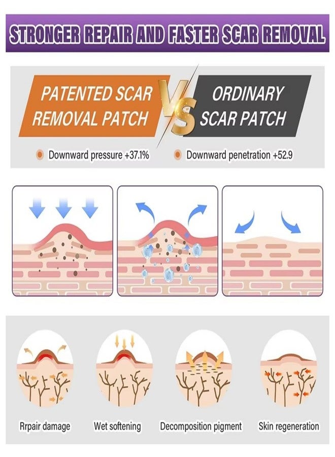 Bokor Silicone Scar Sheets, Silicone Scar Tape for Surgical Scars, Scar Removal Patches with Medical Grade Treatment (1.5M - Image 4
