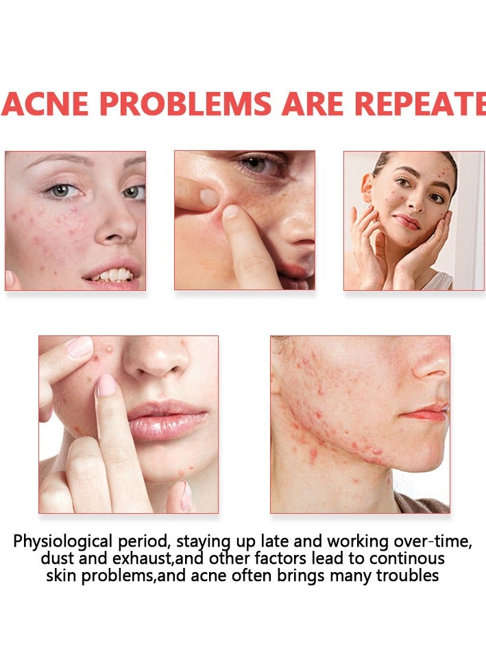 FUSHITING 200 Counts Acne Pimple Patches, Acne Covering Stickers for Face and Skin, Pimple Patch Daily Skin Care Pimple Patches, Hydrocolloid Acne Patches for Face, Colorful Star Pimple Spot Sticker with Hyaluronic Acid, Tea Tree Oil & Centella Oil for Covering Zits and Blemishes Acne Covering Stickers for Face and Skin, Pimple Patch Daily Skin Care - Image 4