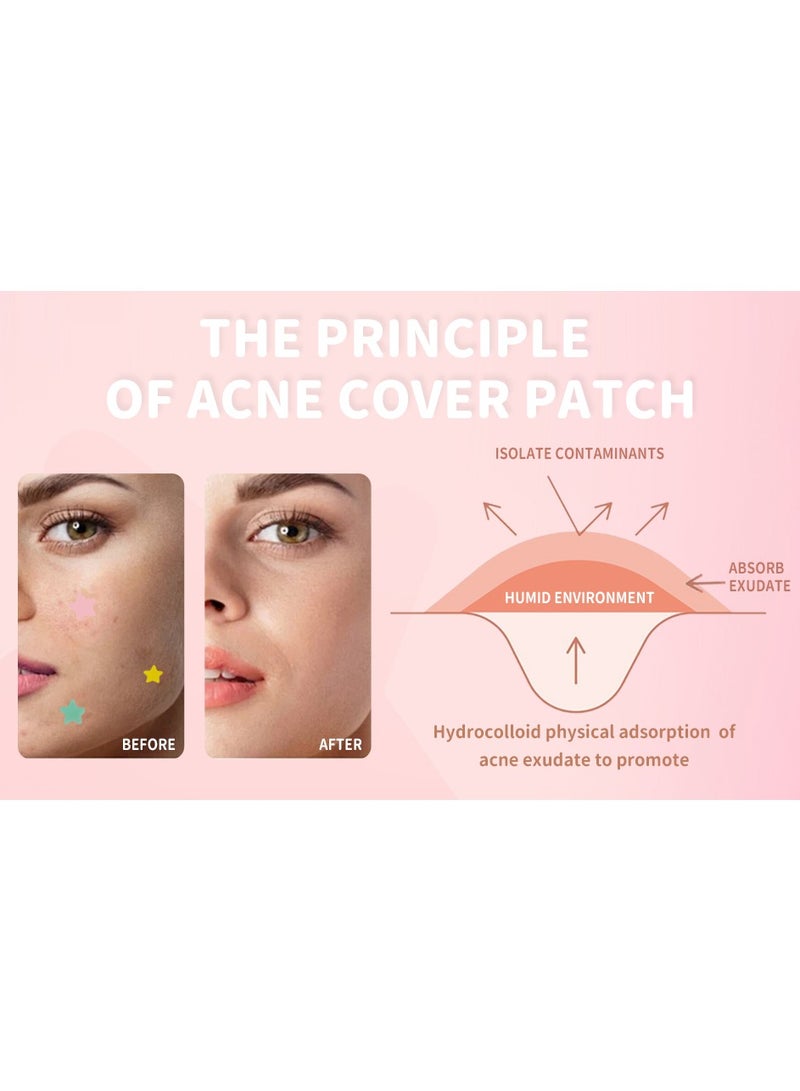 FUSHITING 200 Counts Acne Pimple Patches, Acne Covering Stickers for Face and Skin, Pimple Patch Daily Skin Care Pimple Patches, Hydrocolloid Acne Patches for Face, Colorful Star Pimple Spot Sticker with Hyaluronic Acid, Tea Tree Oil & Centella Oil for Covering Zits and Blemishes Acne Covering Stickers for Face and Skin, Pimple Patch Daily Skin Care - Image 5