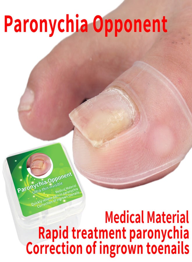 2PCS Ingrown Toenail Correction Tool Toe Cap Toenail Protector Big Toe Sleeves Thick Paronychia Correction Tool - Image 5