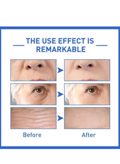SOL LORA Botox Face Serum, Botox Stock Solution Facial Serum, Botox in A Bottle with Vitamin C & E, Anti Aging & Instant Face Tightening, Boost Skin Collagen, Reduce Wrinkles & Plump Skin 30ml  - Image 5