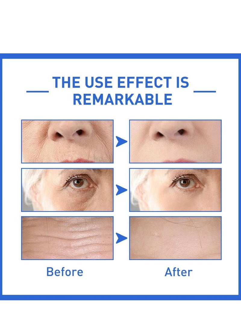SOL LORA - Botox Face Serum, Botox Stock Solution Facial Serum, Botox in A Bottle with Vitamin C & E, Anti Aging & Instant Face Tightening, Boost Skin Collagen, Reduce Wrinkles & Plump Skin 30ml - Image 1