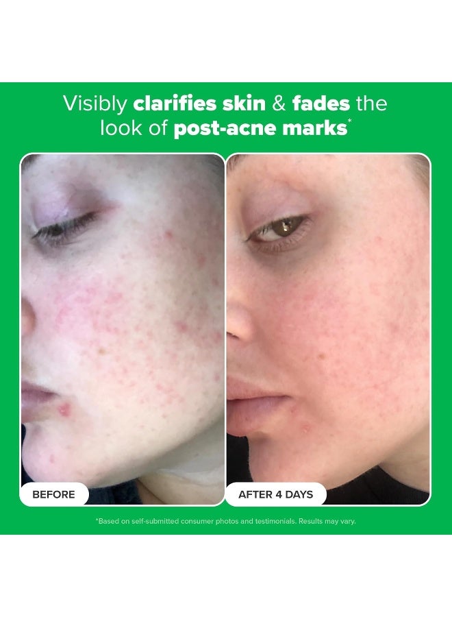 PAULA'S CHOICE Boost 10% Azelaic Acid Booster with Licorice and Salicylic Acid - 1oz Tube - Image 5