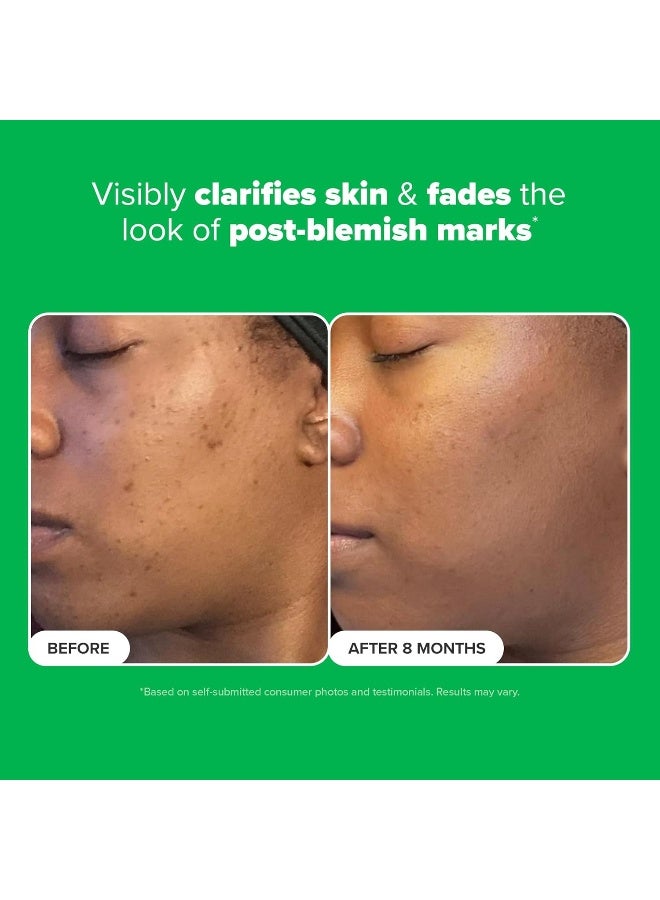 PAULA'S CHOICE Boost 10% Azelaic Acid Booster with Licorice and Salicylic Acid - 1oz Tube - Image 3