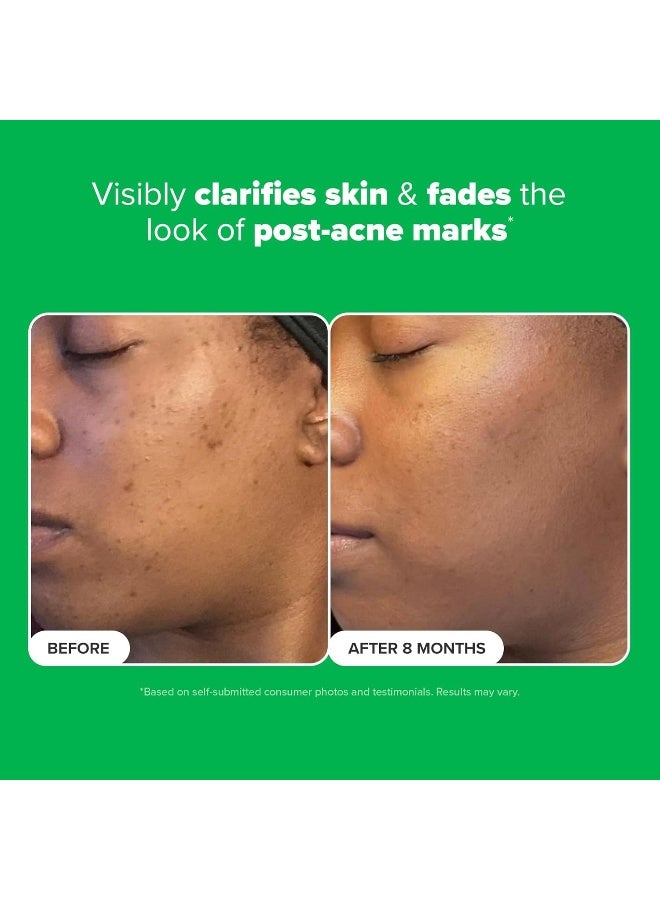 PAULA'S CHOICE Boost 10% Azelaic Acid Booster with Licorice and Salicylic Acid - 1oz Tube - Image 4