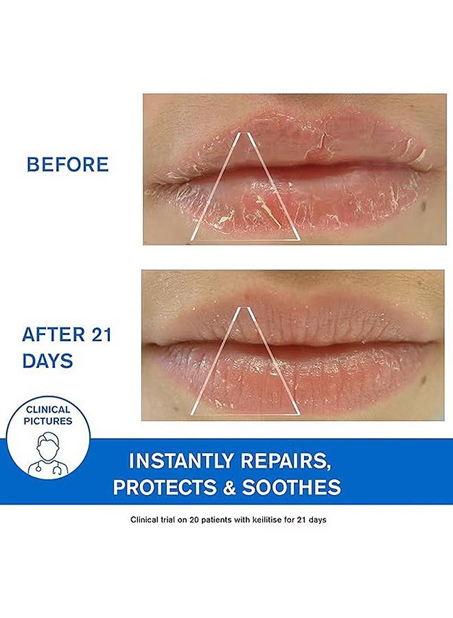 Uriage Ea Thermale Bariederm Cica Repairing Lip Balm, Instantly Soothes Dry Chapped Lips, Lip Soothing Essence Lip Cream 15ML - Image 5
