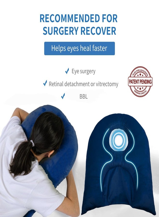 Beatvive Face Down Pillow for Sleeping, Prone Pillow for Vitrectomy or Retinal Surgery, Adjustable Height Face Down Sleep, Retina Lying Eye Surgery Recovery (Velvet-Dark blue) - Image 2