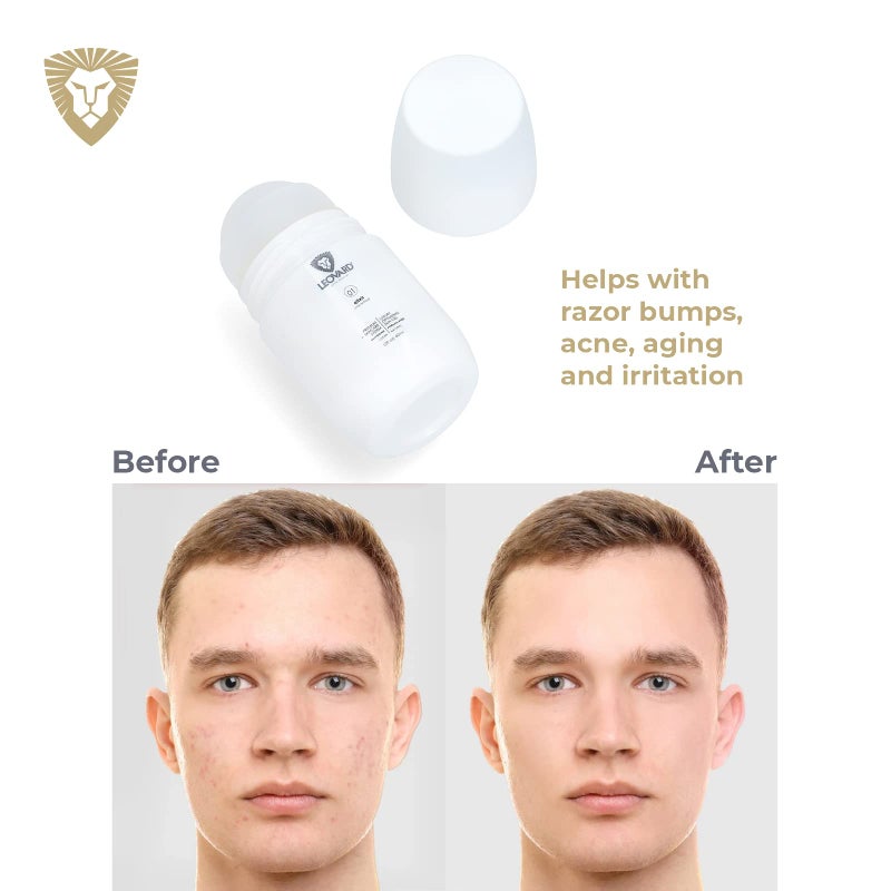 Leovard- Men & Women Razor Bump and Ingrown Hairs Serum - After Your Shave Solution Roll-On for Ingrown Hairs, Razor Bumps, Irritation, Blemishes and Discoloration - Image 4