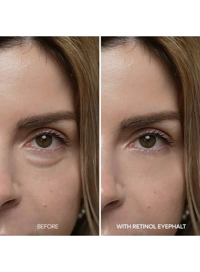Dr. Melaxin Retinol Eyebag Cream – targeted retinol eye bag cream to visibly de-puff, smooth fine lines, and brighten the look of dark circles; lightweight, fast-absorbing under-eye treatment that hydrates, firms the eye contour, and refreshes tired eyes; suitable for all skin types; fragrance-free - Image 5