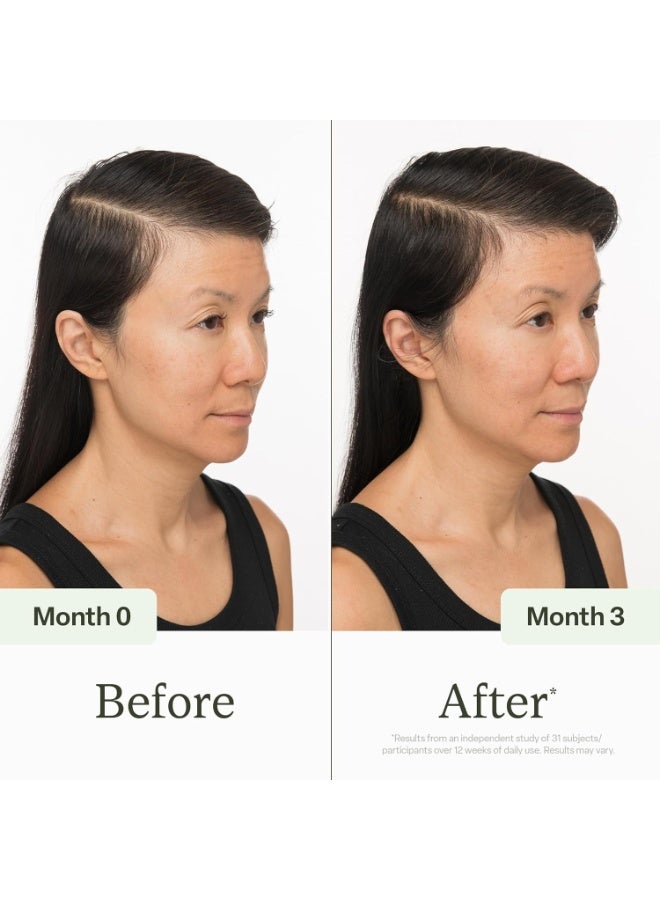 Divi Scalp Serum for Hair Thinning & Scalp Health - 1 fl oz (30ml) - Image 4