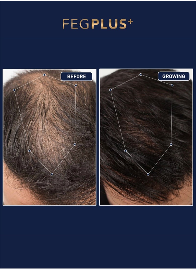 FEG Plus - FEGPLUS Hair Growth Serum - 22% Seaweed Extract For Hair Loss Control & Hair Growth In Men & Women, Boost Thicker Beard & Hair Growth, Improve Baldness | The best hair serum made in the USA (50ml) - Image 1