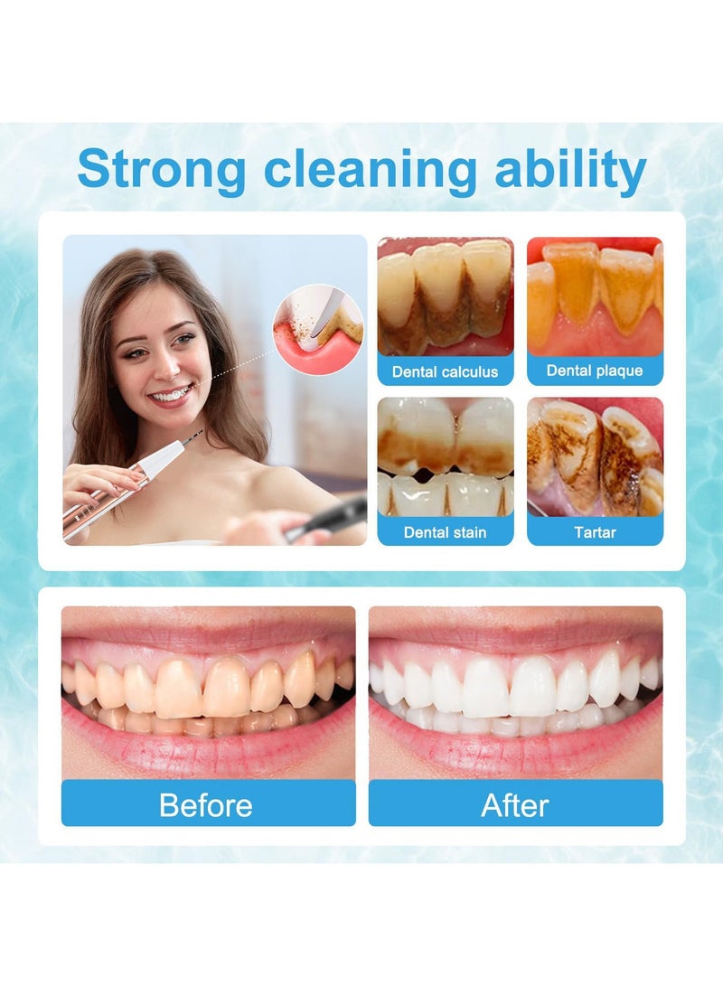 عام جهاز تنظيف الأسنان المنزلية لإزالة الترسبات، أداة تجميلية طبية متنقلة للعناية بالفم، تعمل كمساعد للري والتلميع للأسنان. - Image 3