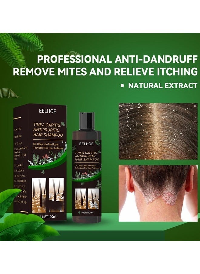 EELHOE شامبو الشعر المضاد للحكة لقشرة الرأس، شامبو مضاد للقشرة، شامبو لفروة الرأس المعرضة لالتهاب الجريبات الشعرية، التهاب الجلد، القشرة، العث، فروة الرأس الحاكة والمتقشرة، يعالج القشرة والتهاب الجلد الدهني - Image 3