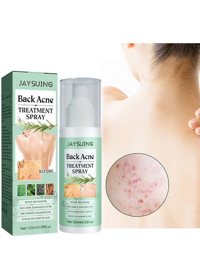 Jaysuing 120ml Back Acne Treatment Spray ,Back Acne Treatment Spray 2% Salicylic Acid Body Acne Treatment with Herbal Formula Back Acne Solution Tea Tree Oil Spray Soothing and Moisturizing Spray for Sensitive  - Image 1