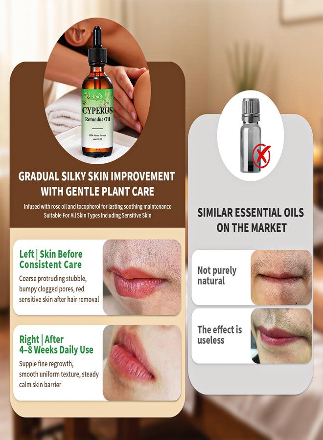 Fovcos 100% Pure Cyperus Rotundus Oil with Sweet Almond & Rosehip – Natural Hair Removal Care & Post-Waxing Soothing Oil for Face, Body, Underarms - Image 5