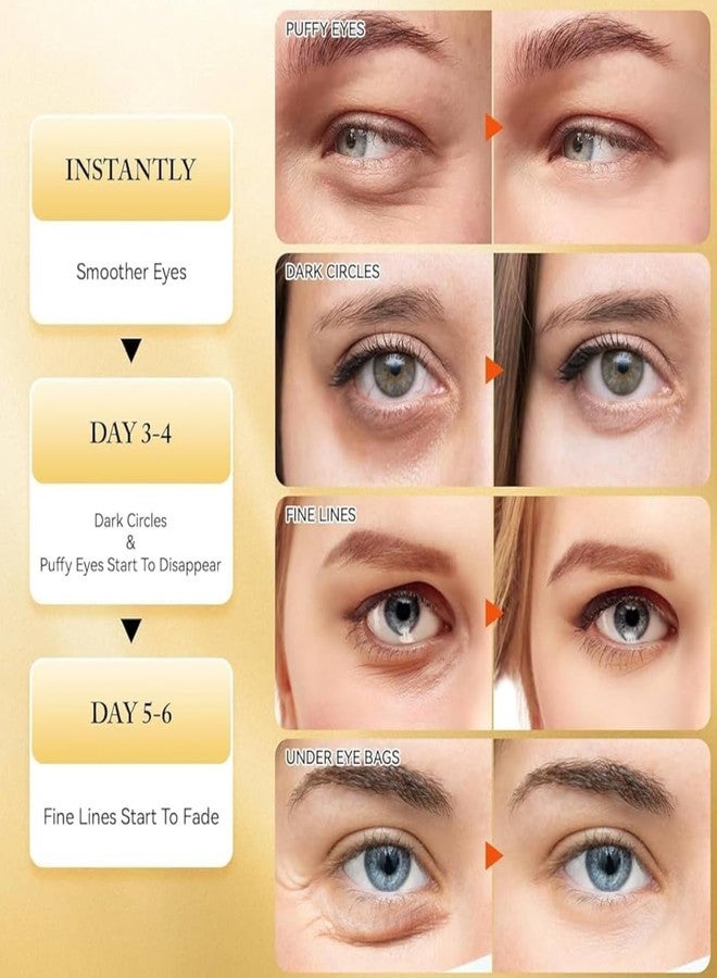 Hidak لصقات هيداك للعين | 60 قطعة من أقنعة العين المطلية بالذهب عيار 24 لعلاج انتفاخات العين والهالات السوداء، وأكياس العين، والتجاعيد، ووسادات هيدروجيل مرطبة لتخفيف جفاف البشرة | عناية بالبشرة مضادة للشيخوخة للرجال والنساء - Image 5