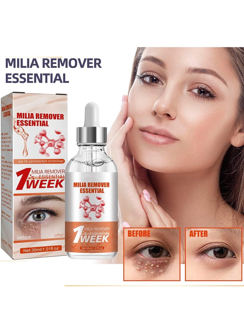 SOUTH MOON Milia Remover Essential Eye Serum Effective Removes Fat Granules Eye Bags Anti-particles Puffiness  - Image 3