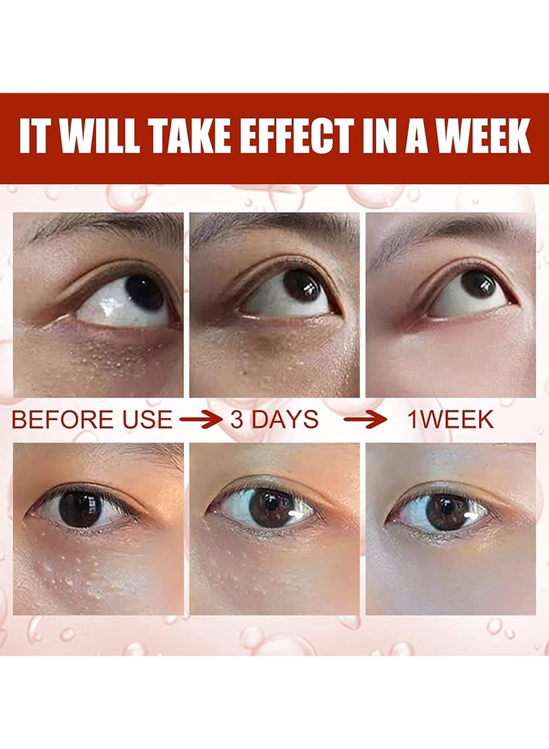 SOUTH MOON Milia Remover Essential Eye Serum Effective Removes Fat Granules Eye Bags Anti-particles Puffiness  - Image 4
