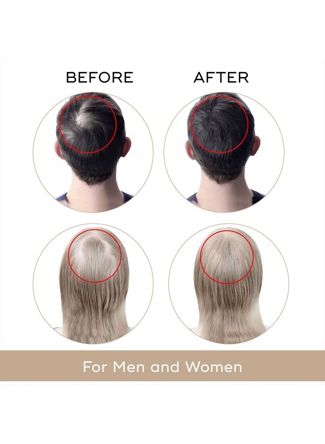 Charismo DEKOHAIR by Charismo USA - 0% Minoxidil Scientific Hair Restoration Serum (2 oz) Regrowth and Anti-Thinning Treatment Stimulates Growth & Thickness, Restores Scalp Health - Image 3