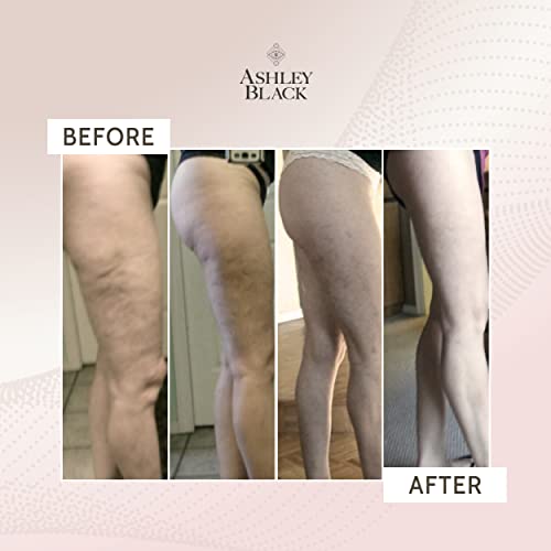 FasciaBlaster The Anti-Cellulite Kit by Ashley Black: Fasciablaster, Mini2, and It's Not Fat, It's Fascia Book – Target Surface Fascia & Deep Myofascial Tissue - Image 4