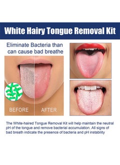 Jaysuing White Hairy Tongue Removal Kit,Tongue Cleaning Gel Set, Tongue Cleaner Gel with Soft Tongue Brush, Easy to Use Tongue Scraper Precise Cleaning Brush Kit, Keep Fresh Breath 50g  - Image 5