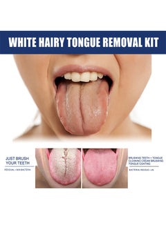 Jaysuing White Hairy Tongue Removal Kit,Tongue Cleaning Gel Set, Tongue Cleaner Gel with Soft Tongue Brush, Easy to Use Tongue Scraper Precise Cleaning Brush Kit, Keep Fresh Breath 50g  - Image 4