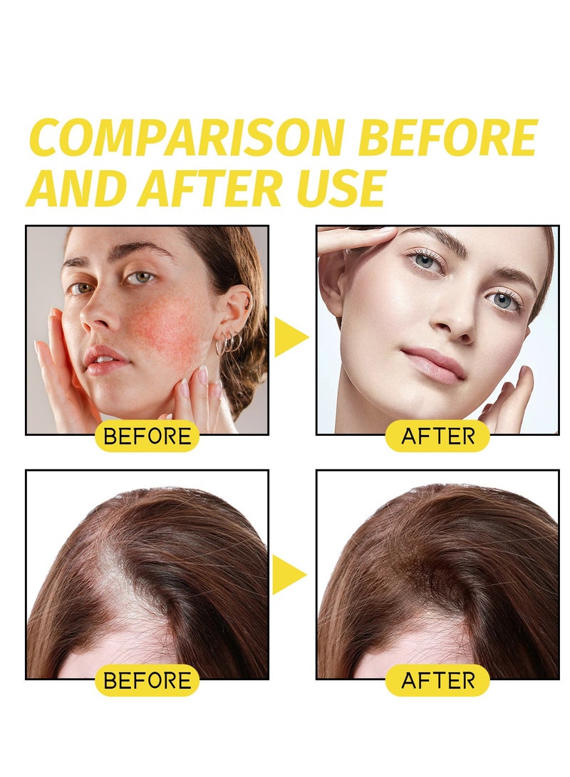 إيلهو مكونات نباتية نقية 100٪ ، حبة سوداء معبأة بمضادات الأكسدة الفائقة الغنية بالأحماض الدهنية والمعادن المختلفة ترطب البشرة وتزيد من لمعان الشعر وسمكها تخترق جذور الشعر بعمق معصور على البارد وخالي من القسوة ونباتي 60 مل - Image 5