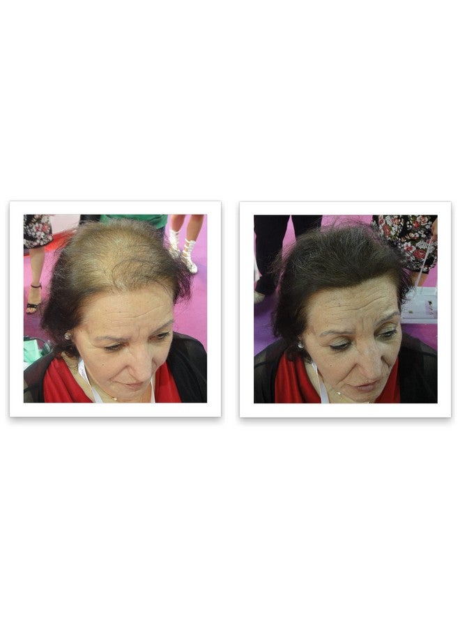 Caboki مستحضر إخفاء تساقط الشعر 90 يوم إمداد بني غامق - Image 4