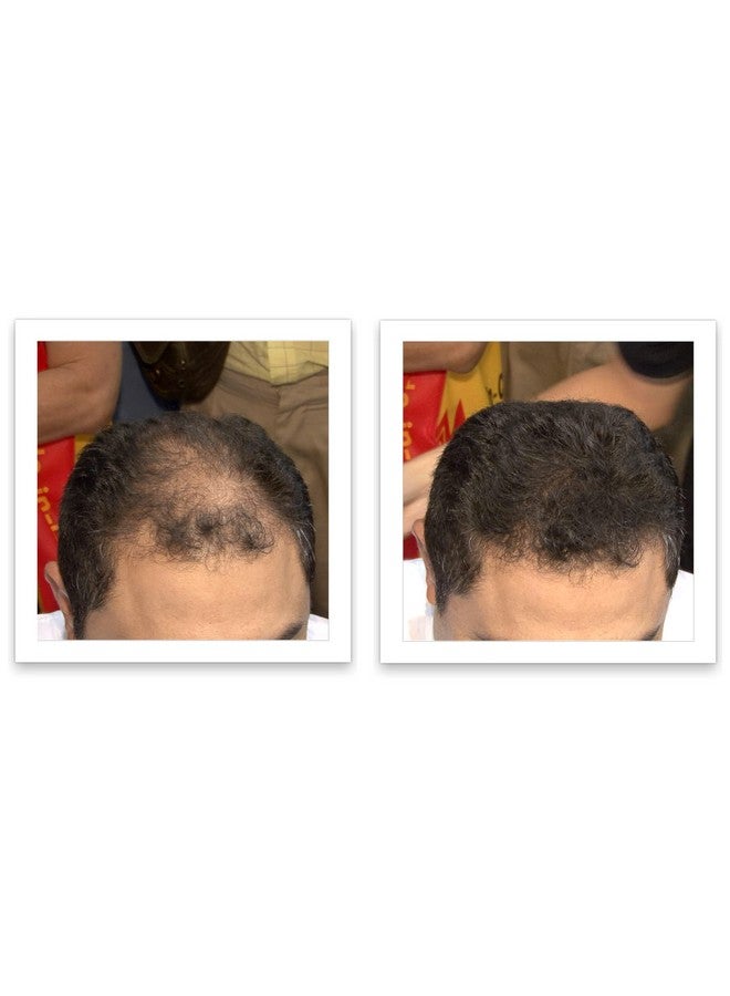 Caboki مستحضر إخفاء تساقط الشعر 90 يوم إمداد بني غامق - Image 5