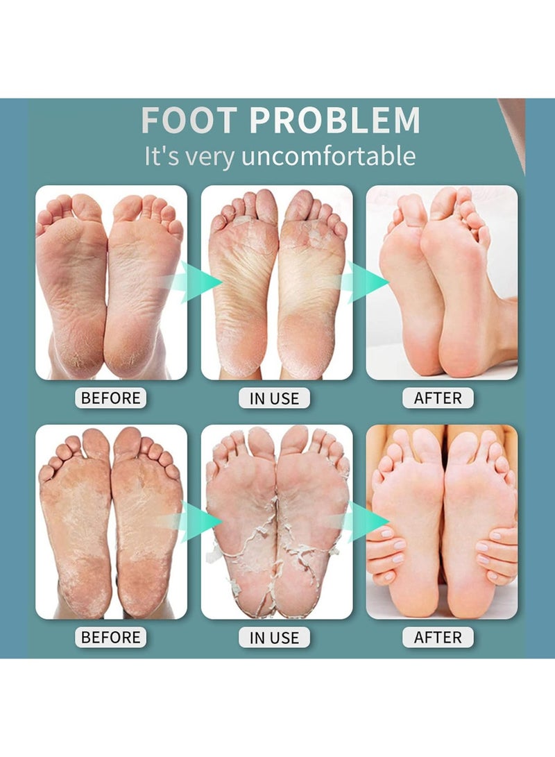 DubaiGallery Foot Spray, Foot Odor and Odor Suppression Beriberi Cream, Can Be Used By Men and Women, Essential for Beriberi 30ml - Image 3