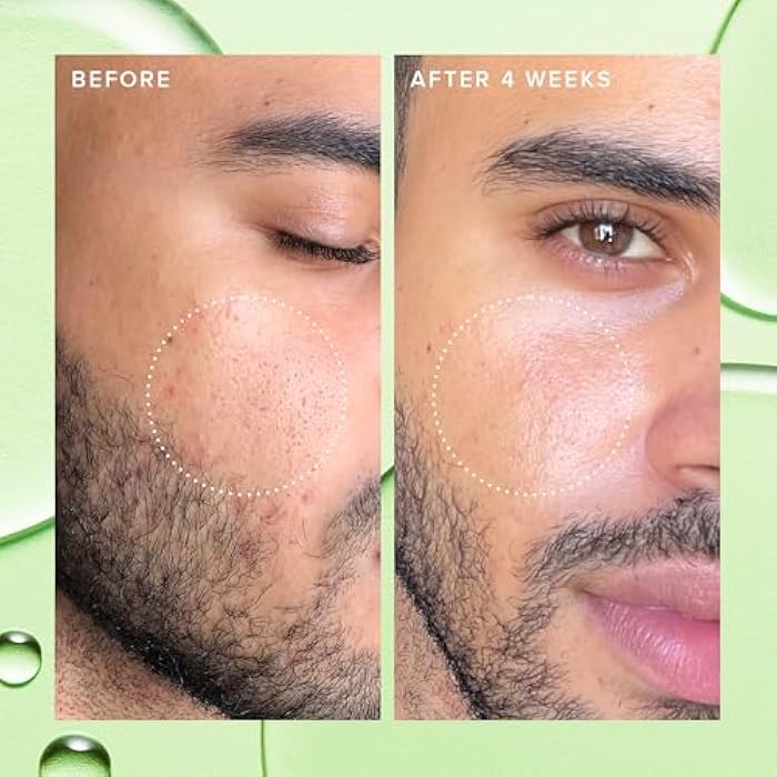Farmacy 2% Salicylic Acid Toner for Face - Deep Sweep Gentle BHA Exfoliant for Oily Skin - Refines Texture with Papaya Enzymes & Moringa Water for a Healthy-Looking Complexion (120ml) - Image 4