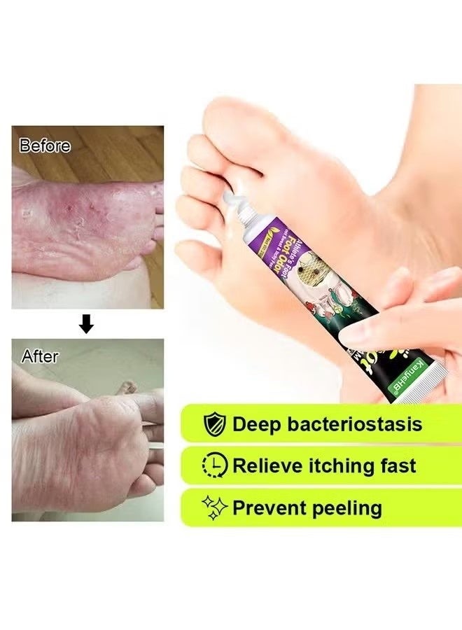 KanyeHB 2 Pcs Dual Action Athletes' Foot Cream, Athlete's Foot Odor Foot Cream，Antifungal Cream, Antibacterial Cream, for Athletes' Foot, Sterilization Treatment Anti-infection Foot Care Repair-20g - Image 3