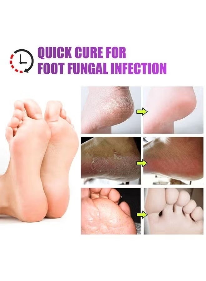 KanyeHB 2 Pcs Dual Action Athletes' Foot Cream, Athlete's Foot Odor Foot Cream，Antifungal Cream, Antibacterial Cream, for Athletes' Foot, Sterilization Treatment Anti-infection Foot Care Repair-20g - Image 5