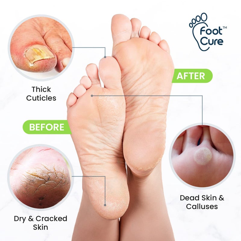 Foot Cure Toenail Fungus Treatment Extra Strength - for fingernails, nail repair, toenail softener, yellow toenail treatment, ingrown nail and foot fungus treatment extra strength - Image 2