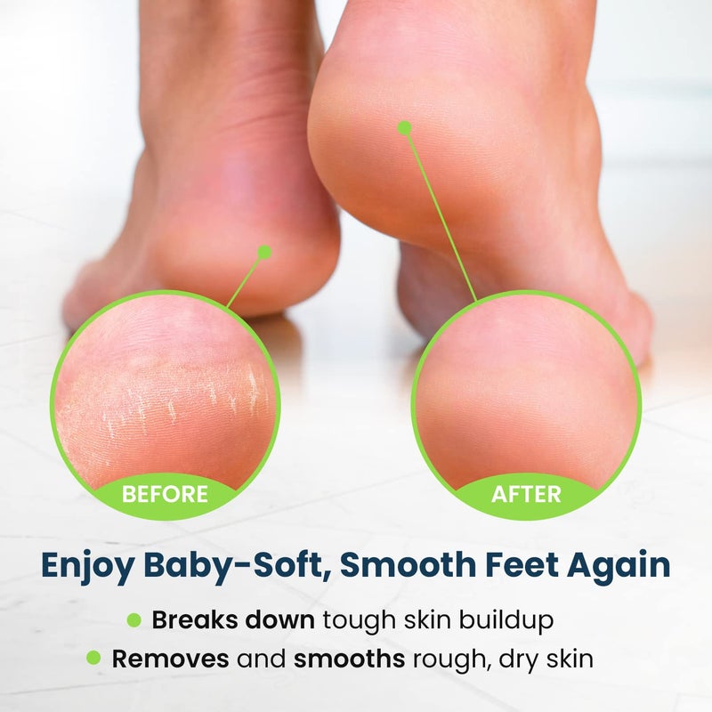 Foot Cure Toenail Fungus Treatment Extra Strength - for fingernails, nail repair, toenail softener, yellow toenail treatment, ingrown nail and foot fungus treatment extra strength - Image 4