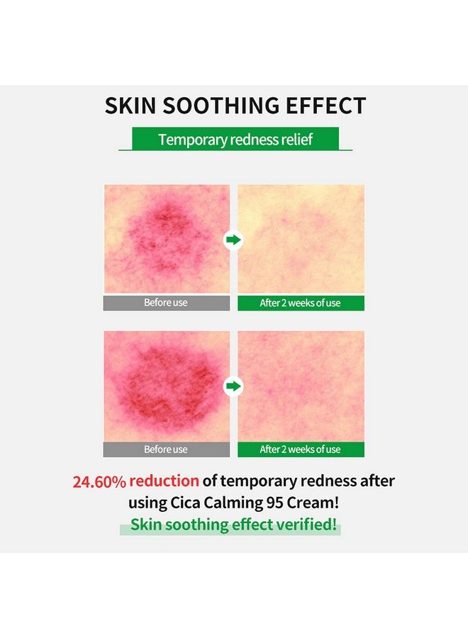 ويليدج كريم ويلاج سيكا المهدئ 2.7 أونصة - مرطب مهدئ للوجه مع ماديكاسوسيد عالي النقاء - يهدئ البشرة الحساسة، مضاد للاحمرار، مضاد للتقشر - Image 5