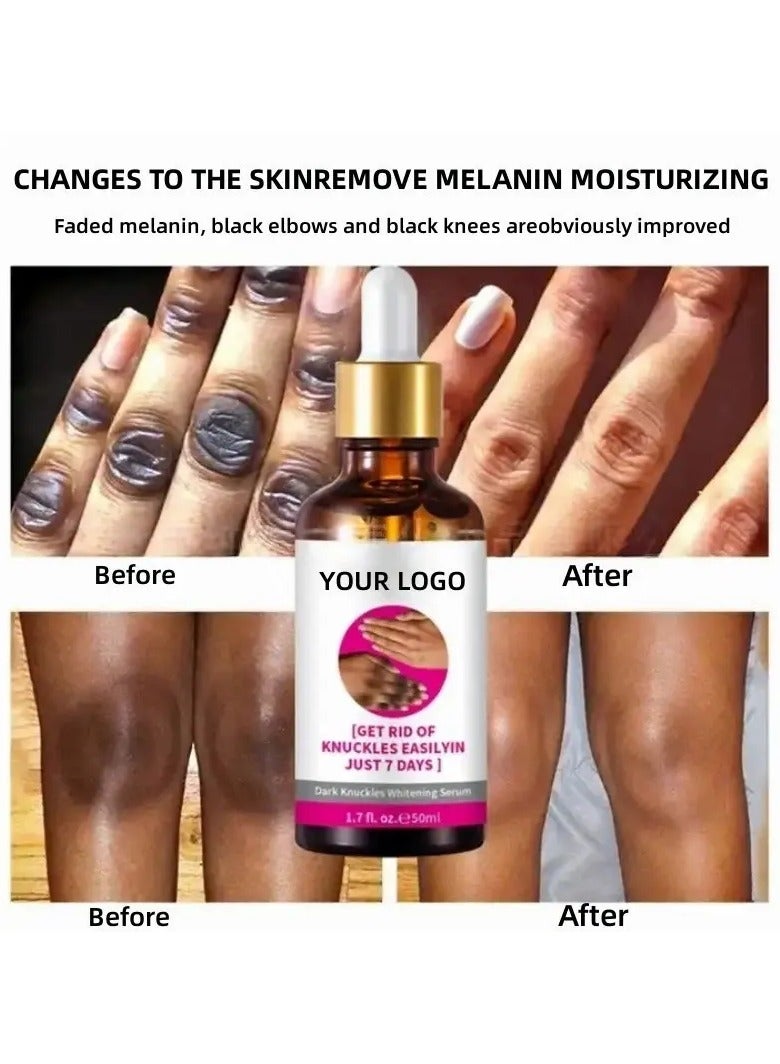 Kormesic سيروم تفتيح لتوحيد لون البشرة 50مل – للعناية بالمفاصل والركب الداكنة وترطيب البشرة - Image 2