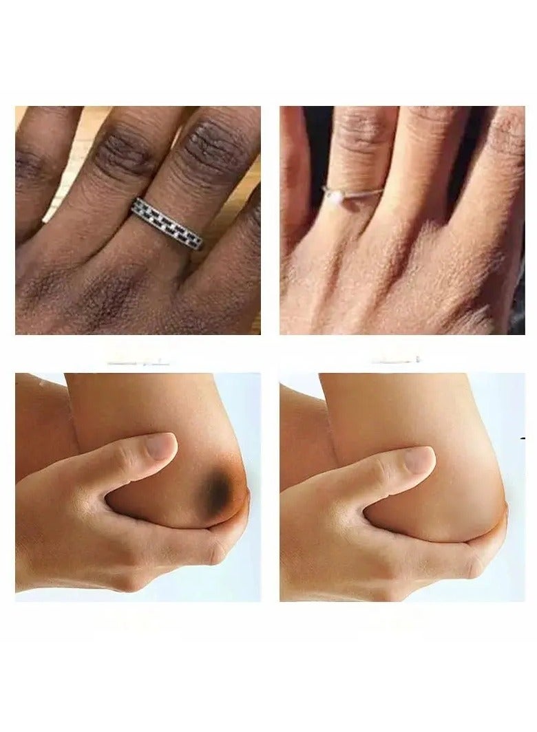 Kormesic سيروم تفتيح لتوحيد لون البشرة 50مل – للعناية بالمفاصل والركب الداكنة وترطيب البشرة - Image 4