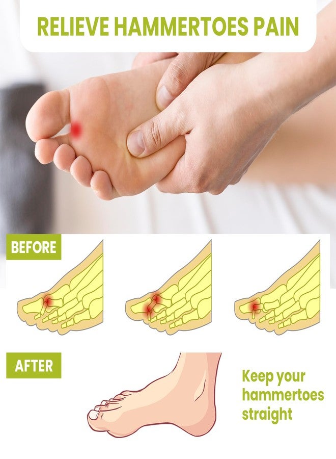Bukihome Hammertoe Corrector Gel Toe Straighteners - 12 pcs Support Crest for Women & Men - Realign Bent, Crooked, Curled, Claw, Hammer Toes - Clear,Single Loop - Image 4