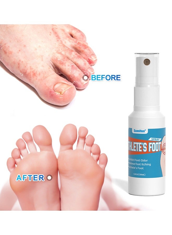 سوميفون بخاخ القدم الرياضي ، علاج مضاد للفطريات لحكة القدمين والتعرق والتقشير والبثور ، مكونات طبيعية بخاخ فطريات القدم لسعفة بيديس 30 مل - Image 2