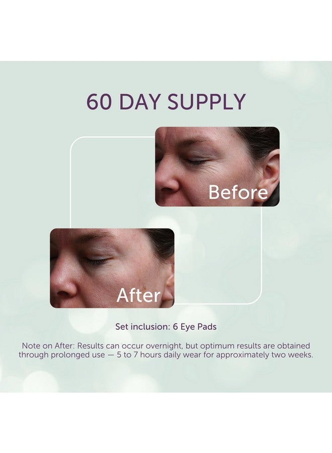 Silc Skin SilcSkin Silicone Eye Pads - Reusable Overnight Eye Patches, Medical-grade Silicone for Fine Lines, Crepey Skin, and Puffiness - 60 Day Supply - Image 3