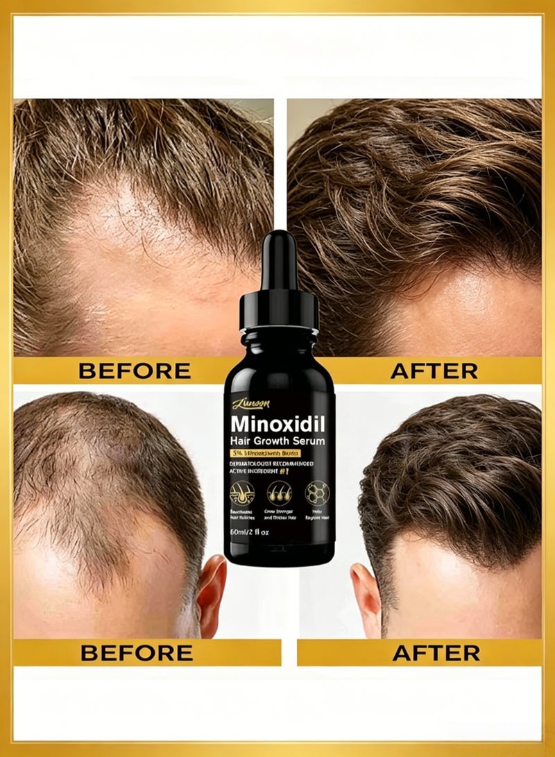 LUNOON 🌱 [5% Minoxidil + Biotin · Follicle-Activating Hair Growth Serum] Dermatologist-Recommended Active Ingredient | Strengthens Roots × Thickens & Densifies Hair | Revives Dormant Follicles · Reduces Hair Loss | Unisex · 60ml Large Capacity | Twice Daily · Visible Regrowth Results! - Image 2
