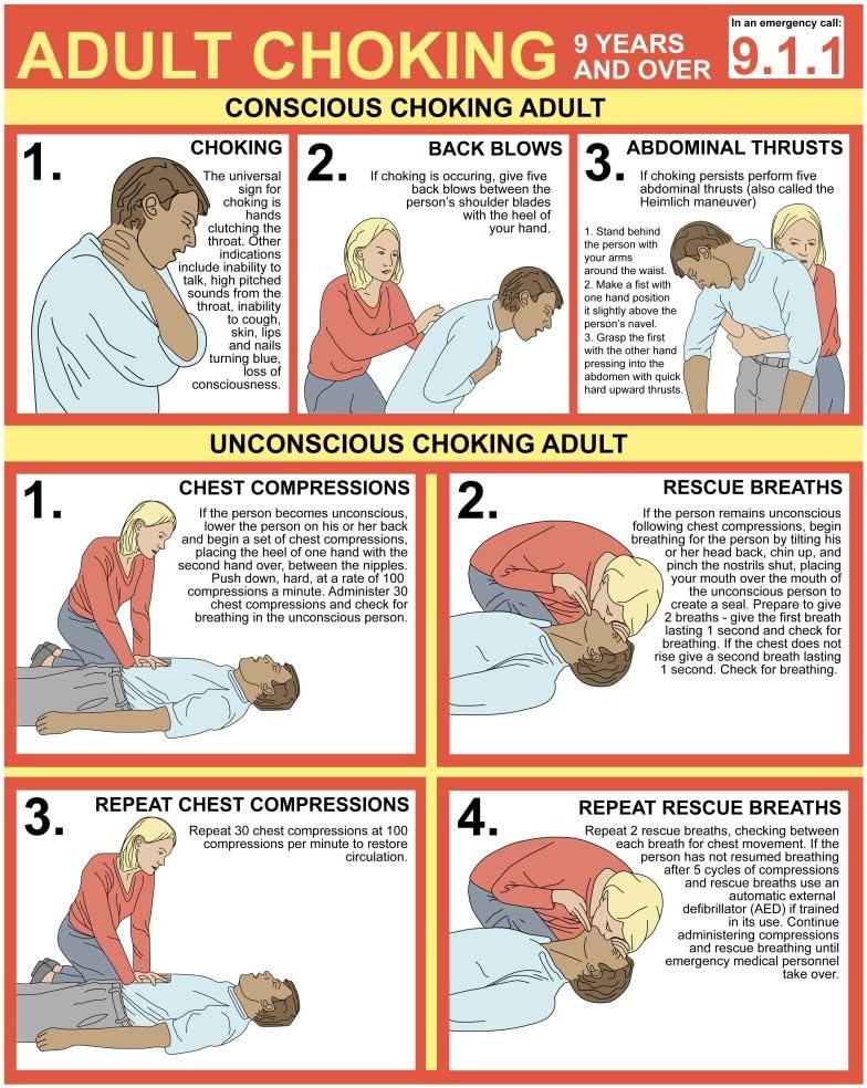 Posterazzi Choking First Aid Chart Poster Print by Gwen ShockeyScience Source (24 x 36)