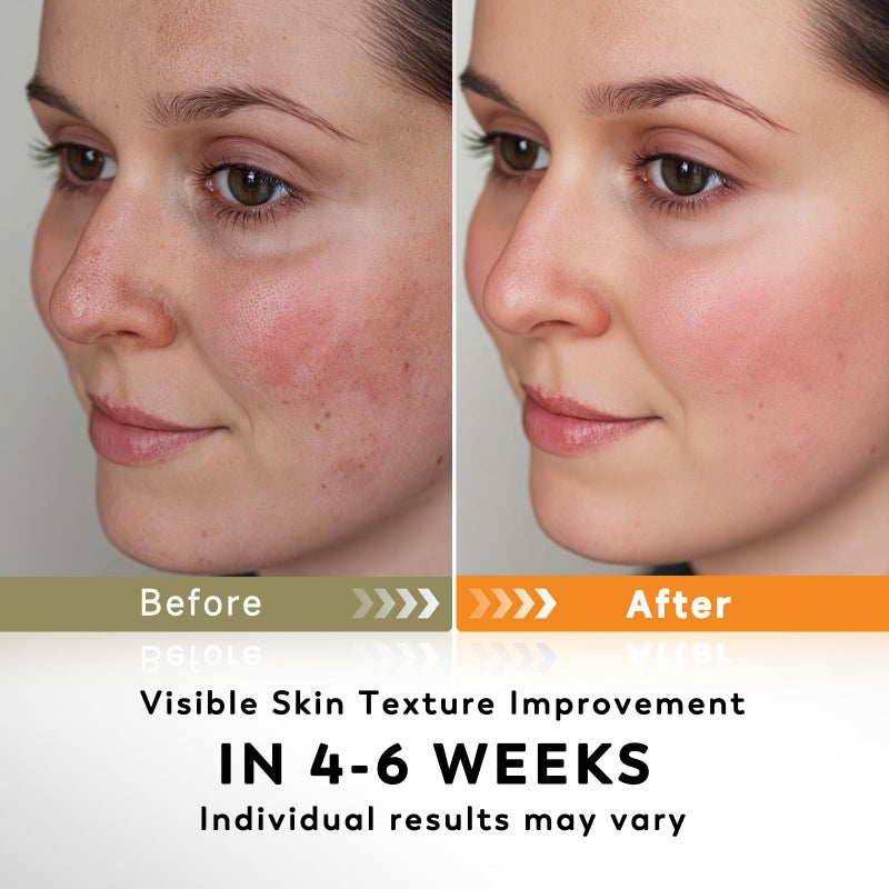 Rvlaim Turmeric Kojic Acid Cleansing Pads, 50 PCS Turmeric Pads for Face Dark Spots Cleansing & Exfoliation - Image 3
