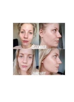 Nourish 2% Hyaluronic Acid + Vitamin C Serums( Buy One Get One) - 2*30ml  - Image 3