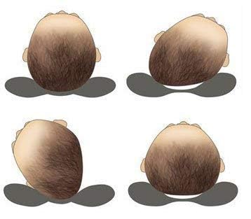 mittenbooty mittenbooty Newborn Round Pillow Cotton Mustard SeedsRound Rai Pillow or Head Shaping PillowTakiya for Infant Baby with Detachable Pouch for Easy Washing - Image 4