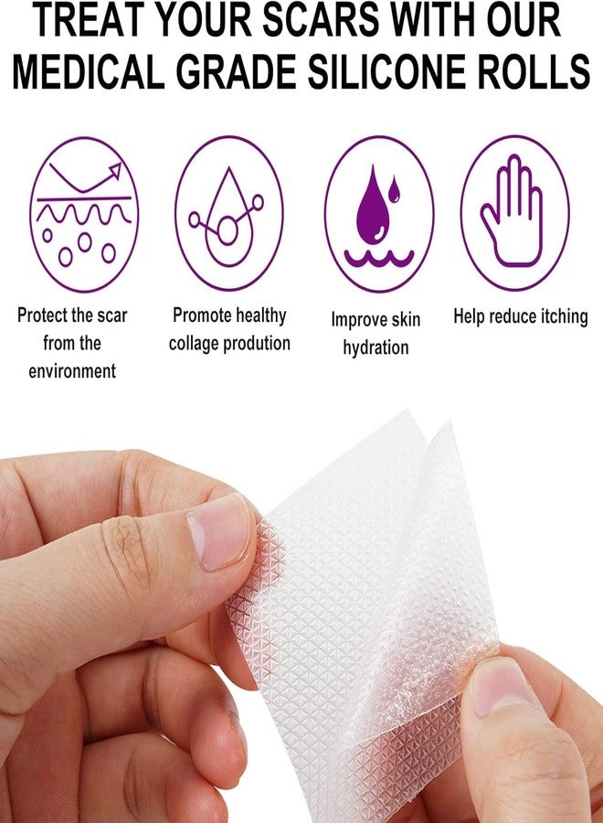 JOICE IMPEX Silicone Scar Tape for Surgical Scars - 60" x 1.6" Roll - Extra Long Scar Sheets for C-Section, Tummy Tuck, Keloid, and Surgical Scars - Reusable Medical Grade Silicone Scar Tape (White) - Image 4