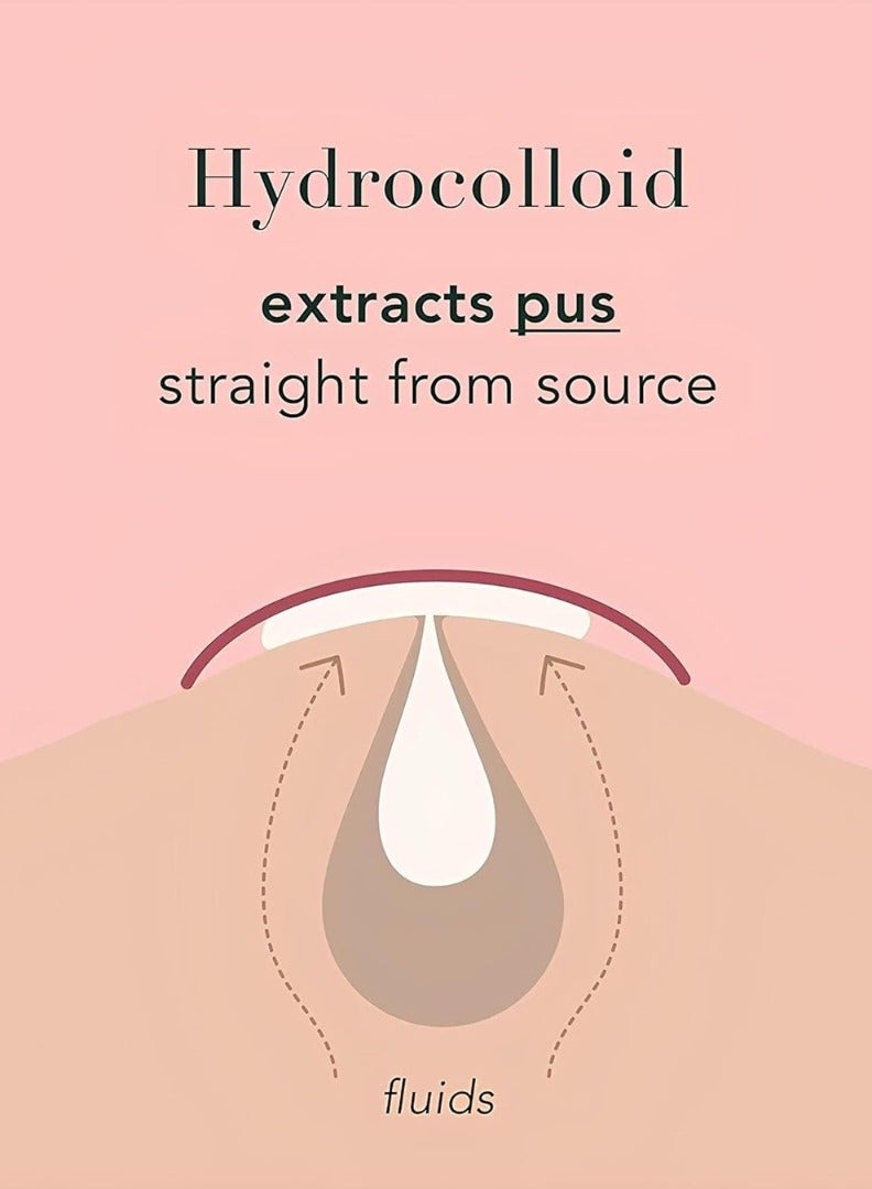 Kormesic 84 pcs Acne Pimple Patches Hydrocolloid patch with Tea Tree Oil Cruelty Free Acne absorbing Patches Pimple Spot Stickers Spot Treatment Acne Cover Patch Salicylic Acid pimple Stickers - Image 3