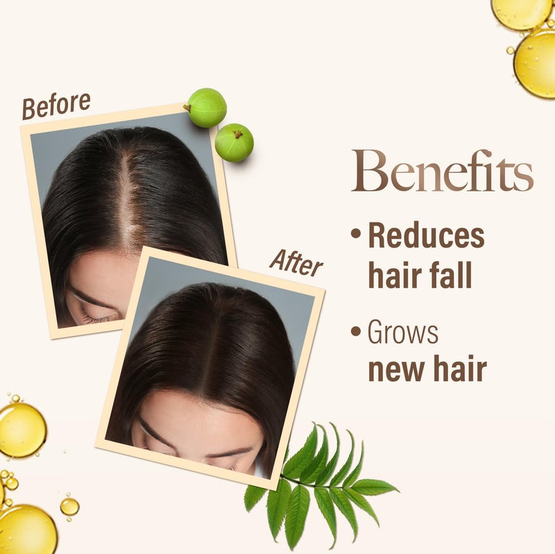 Kesh King Ayurvedic Hair Oil | Herbal Oil with Bhringraj & Amla | Enhance Hair Growth | Reduce Hairfall | Nourishes Scalp | Provides Long & Thick Hair | 10.14 Fl Oz/300ml - Image 4