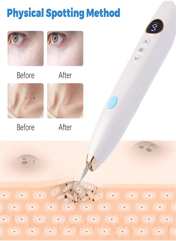 Generic - Mole Laser Pointer, Spot Eraser with 9 Modes and LCD Display, Replaceable Needle, USB Rechargeable Mole Removal Pen Skin Tag Removal Tool for Warts Spots Tattoos Body Freckles - Image 1